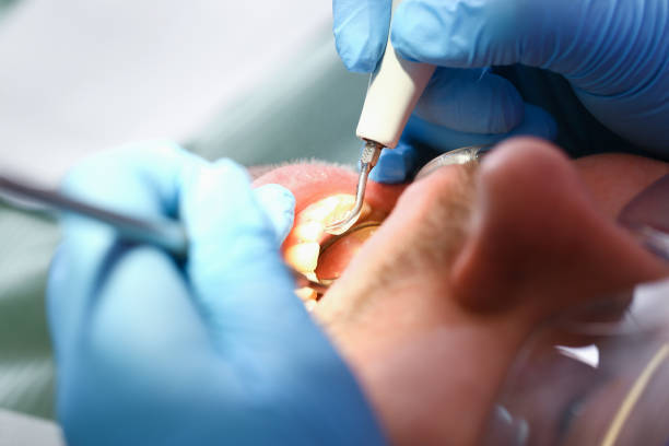 Best Walk-In Emergency Dental Services in Mclean, TX