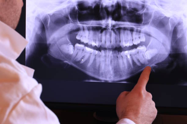 Best Emergency Denture Repair in Mclean, TX